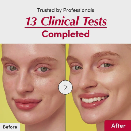 Siero Illuminante Anti-Rughe con Bakuchiol